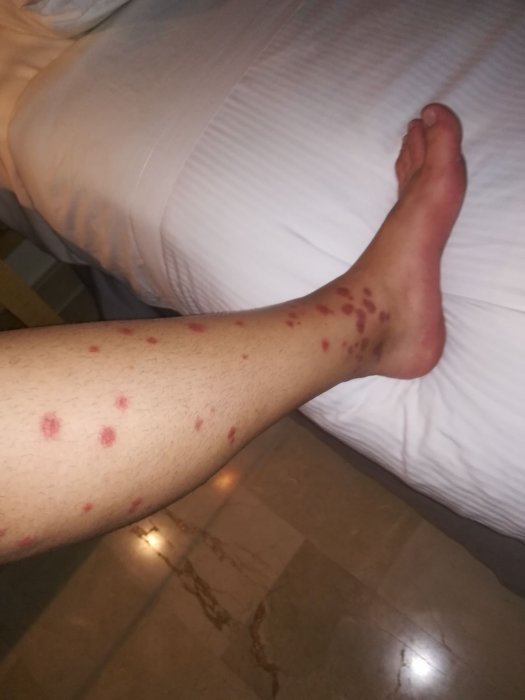 Mosquitos en Punta Cana y Rep. Dominicana 0