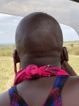 Dilataciones Masai