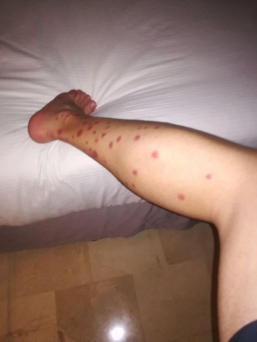 Mosquitos en Punta Cana y Rep. Dominicana 2